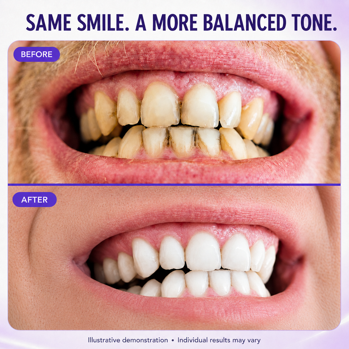 Teeth Color Correcting Tablets